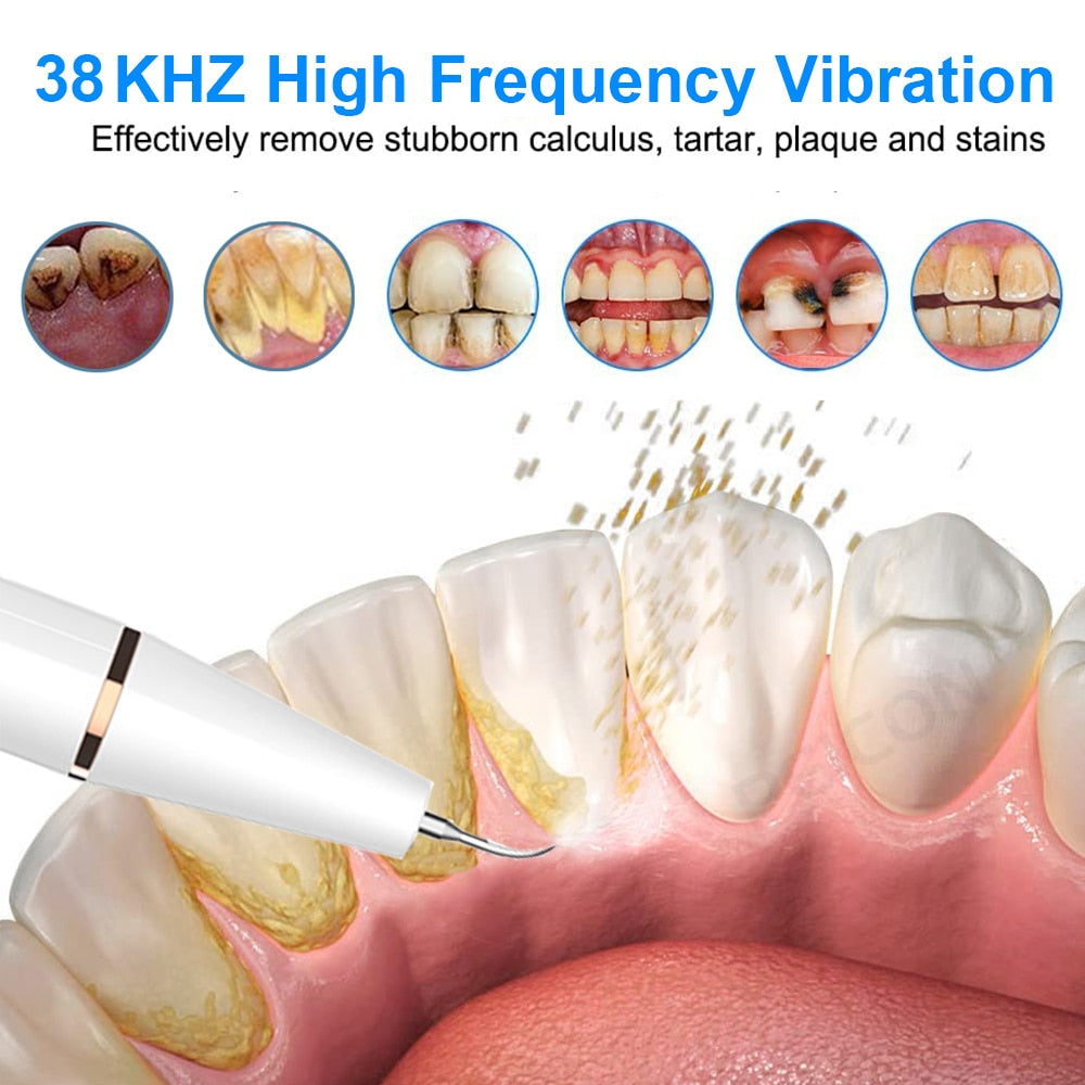 Electric Sonic Teeth Plaque Cleaner