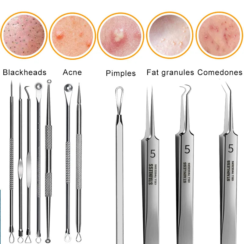 11PCS Ingrown Hair Tweezers Acne Blackhead Removal